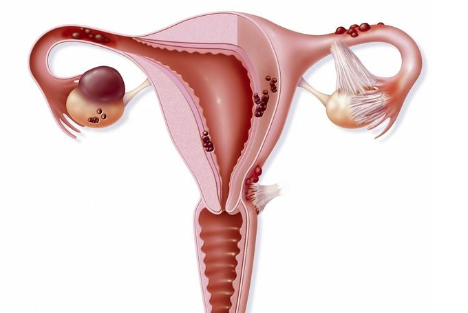 备孕检查做输卵管造影疼吗 影响输卵管造影疼痛的因素