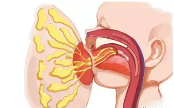 乳腺炎脓肿特征有哪些 乳腺炎脓肿会发烧吗