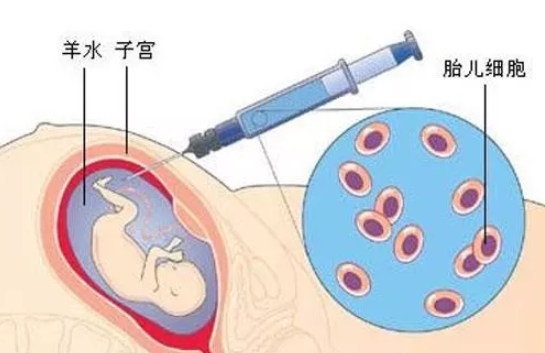 妊娠疱疹是什么引起的 单纯疱疹病毒对孕妇的影响