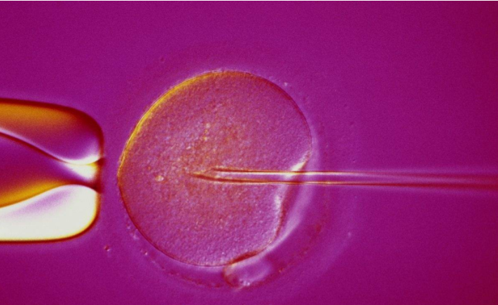 人工受孕怎么取出精子的 人工受孕成功率高吗