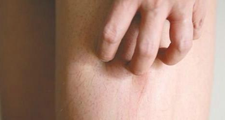 剖腹产疤痕对女性有什么影响 剖腹产女性疤痕不明显是什么原因